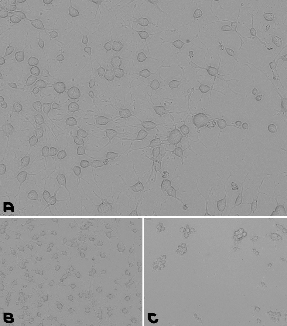 Microscopy images of cell adhesion during a neural stem cells culturing assay