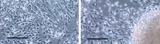  EB Selection in defined medium. Morphology of putative NSCs produced from iPSCs cells by various protocols. Scale bar: 100 µm.