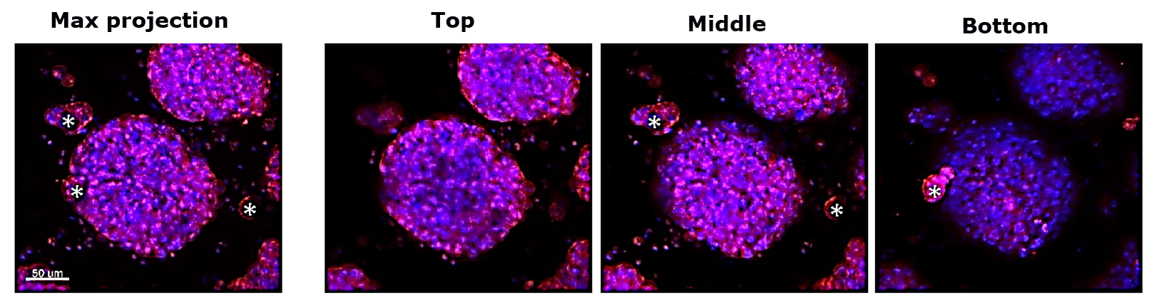 Application of TrueGel® HTS hydrogels in tumor spheroid formation and tumor cell invasion