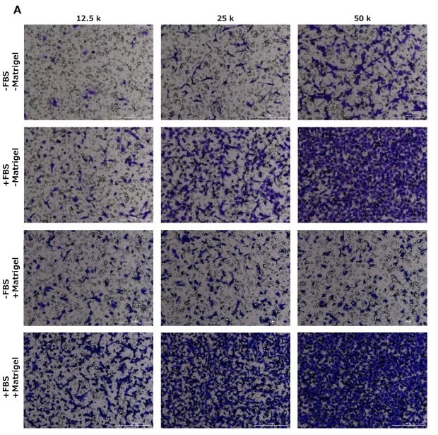 Cell migration assay, crystal violet staining, HT1080, NIH 3T3, MCF-7