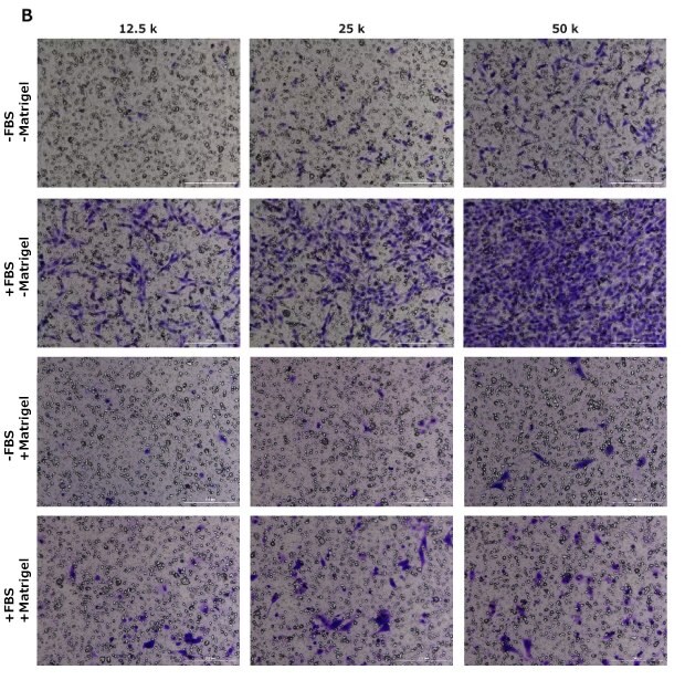 Cell migration assay, crystal violet staining, HT1080, NIH 3T3, MCF-7