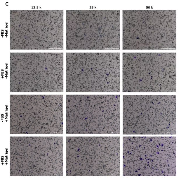 Cell migration assay, crystal violet staining, HT1080, NIH 3T3, MCF-7