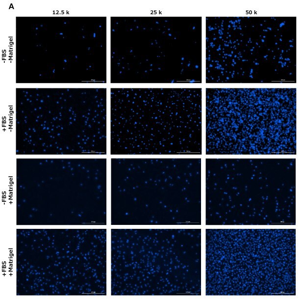 DAPI staining of cells in migration assay