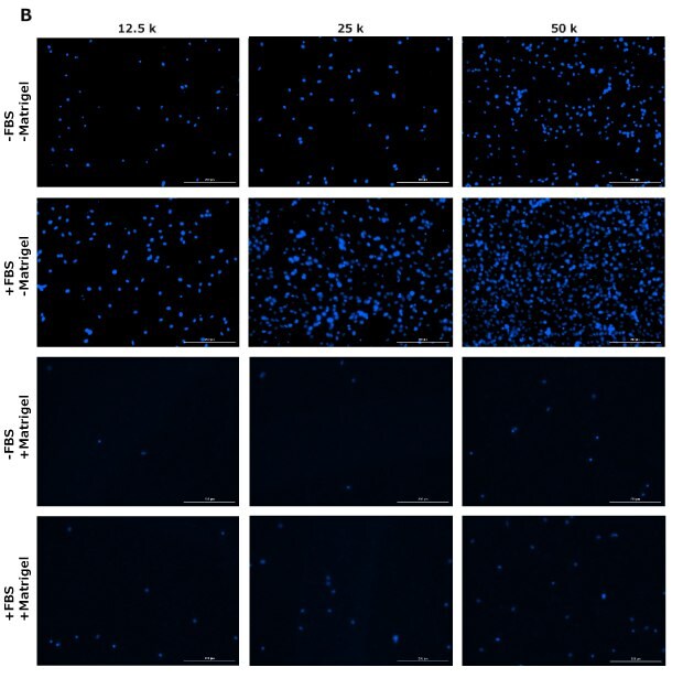 DAPI staining of cells in migration assay