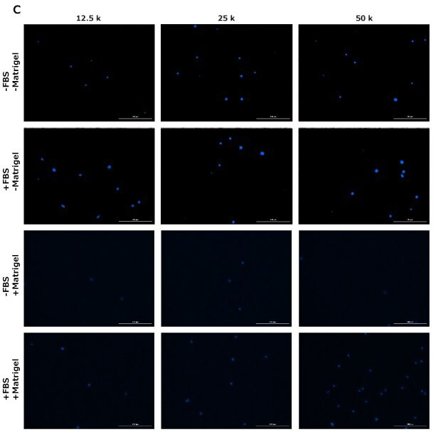 DAPI staining of cells in migration assay