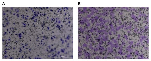 Crystal violet staining of Millicell® inserts