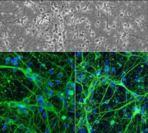 Neuron Neuron