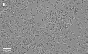 millicell-cell-lines-85011425-b Brightfield imaging of L929 cells on Millicell<sup>®</sup> DCI Digital Cell Imager at 20X magnification