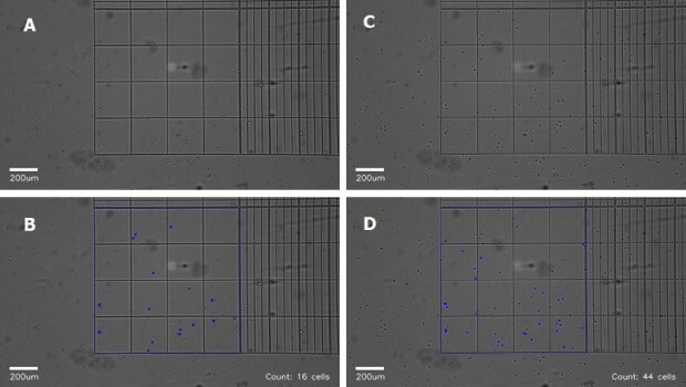 Optimizing cell counting on the Millicell® DCI Digital Cell Imager