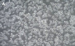 ALMC-1 cells imaged on Millicell® DCI Digital Cell Imager Brightfield imaging of ALMC-1 cells on Millicell<sup>®</sup> DCI Digital Cell Imager at 10X magnification