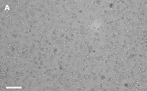 OSUMMER.1 cells imaged on Millicell<sup>®</sup> DCI Digital Cell Imager Brightfield imaging of OSUMMER.1 cells on Millicell<sup>®</sup> DCI Digital Cell Imager at 10X magnification