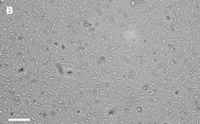Masked OSUMMER.10 cells on Millicell<sup>®</sup> DCI Digital Cell Imager Brightfield imaging of OSUMMER.10 cells on Millicell<sup>®</sup> DCI Digital Cell Imager at 10X magnification with mask