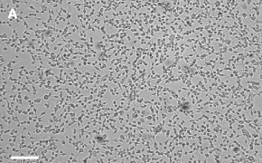 OSUMMER.11 cells imaged on Millicell<sup>®</sup> DCI Digital Cell Imager Brightfield imaging of OSUMMER.11 cells on Millicell<sup>®</sup> DCI Digital Cell Imager at 10X magnification