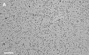 OSUMMER.4 cells imaged on Millicell<sup>®</sup> DCI Digital Cell Imager Brightfield imaging of OSUMMER.4 cells on Millicell<sup>®</sup> DCI Digital Cell Imager at 10X magnification