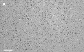 OSUMMER.6 cells imaged on Millicell<sup>®</sup> DCI Digital Cell Imager Brightfield imaging of OSUMMER.6 cells on Millicell<sup>®</sup> DCI Digital Cell Imager at 10X magnification