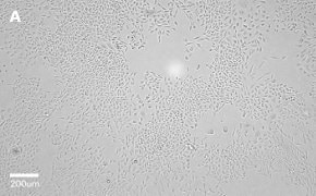 CHO-K1 cells imaged on Millicell<sup>®</sup> DCI Digital Cell Imager, 10X Brightfield imaging of CHO-K1 cells on Millicell<sup>®</sup> DCI Digital Cell Imager at 10X magnification