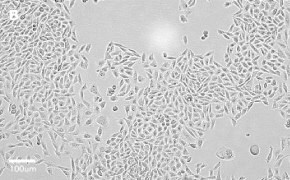 CHO-K1 cells imaged on Millicell<sup>®</sup> DCI Digital Cell Imager, 20X Brightfield imaging of CHO-K1 cells on Millicell<sup>®</sup> DCI Digital Cell Imager at 20X magnification