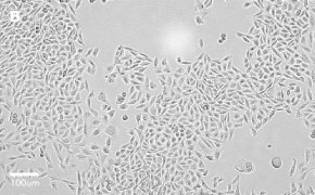 Brightfield imaging of CHO-K1 cells on Millicell<sup>®</sup> DCI Digital Cell Imager at 20X magnification