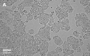 HT29 cells imaged on Millicell<sup>®</sup> DCI Digital Cell Imager, 10X Brightfield imaging of HT29 cells on Millicell<sup>®</sup> DCI Digital Cell Imager at 10X magnification