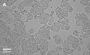 Brightfield imaging of HT29 cells on Millicell<sup>®</sup> DCI Digital Cell Imager at 10X magnification