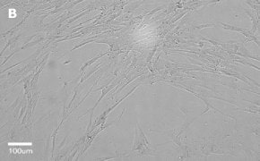 Brightfield imaging of IMR-90 cells on Millicell<sup>®</sup> DCI Digital Cell Imager at 20X magnification