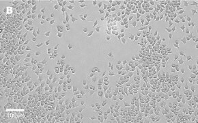 Brightfield imaging of J774A.1 cells on Millicell<sup>®</sup> DCI Digital Cell Imager at 20X magnification