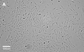MDCK cells imaged on Millicell<sup>®</sup> DCI Digital Cell Imager, 10X Brightfield imaging of MDCK cells on Millicell<sup>®</sup> DCI Digital Cell Imager at 10X magnification
