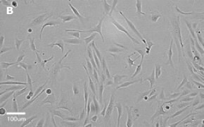 Brightfield imaging of MDCK cells on Millicell<sup>®</sup> DCI Digital Cell Imager at 20X magnification