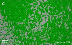 Brightfield imaging of MG-63 cells on Millicell<sup>®</sup> DCI Digital Cell Imager at 10X magnification with mask