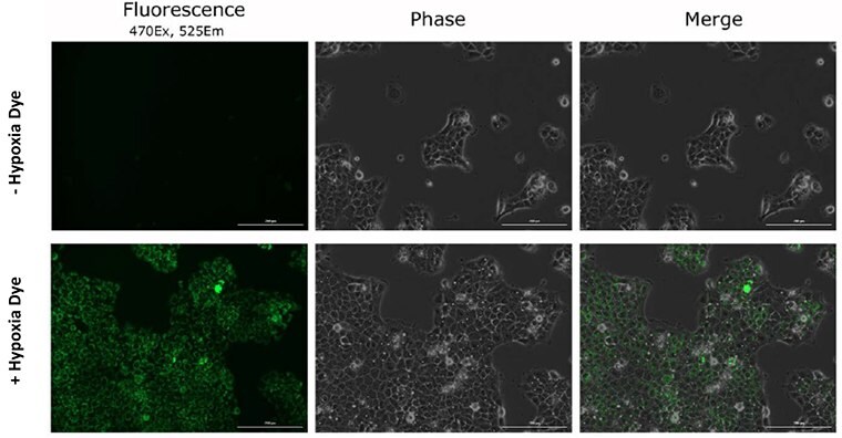 Dye specificity of hypoxia in live cancer cells.