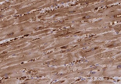 Immunohistochemical staining of cardiac muscle cell showing high expression of Fatty Acid Binding Protein 3 in human heart muscle using Anti-FABP3 polyclonal antibody Immunohistochemical staining of cardiac muscle cell