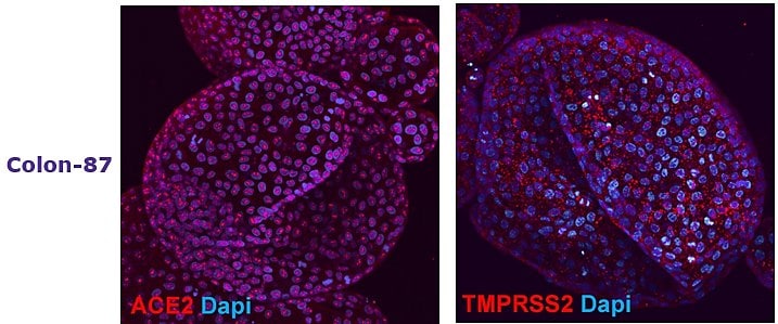 Adult tissue derived colon (SCC321, Colon-87) and duodenum (SCC320, DUO-85) organoids express SARS-CoV-2 related proteins ACE2 and TMPRSS2.