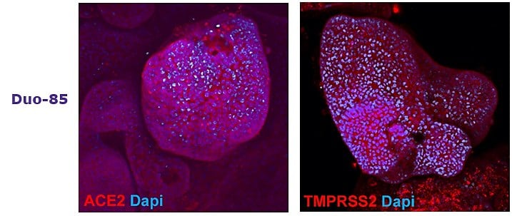 Adult tissue derived colon (SCC321, Colon-87) and duodenum (SCC320, DUO-85) organoids express SARS-CoV-2 related proteins ACE2 and TMPRSS2.