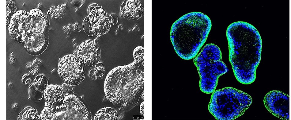 Fluorescent and contrast imaging of apical out gut organoids 