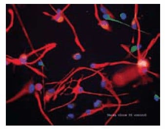 Immortalized cortical cell line in the presence of growth factors