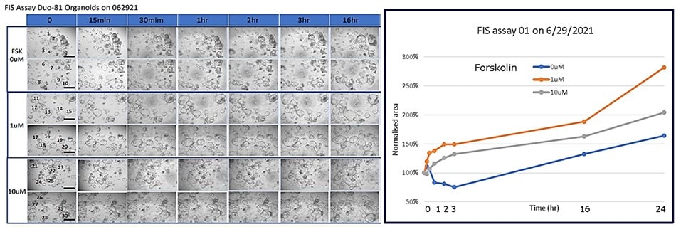 Forskolin-induced swelling of duodenum gut organoids.