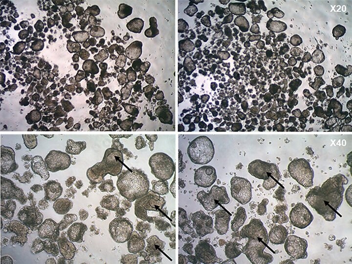human-lung-bud-organoids-in-suspension-cultures