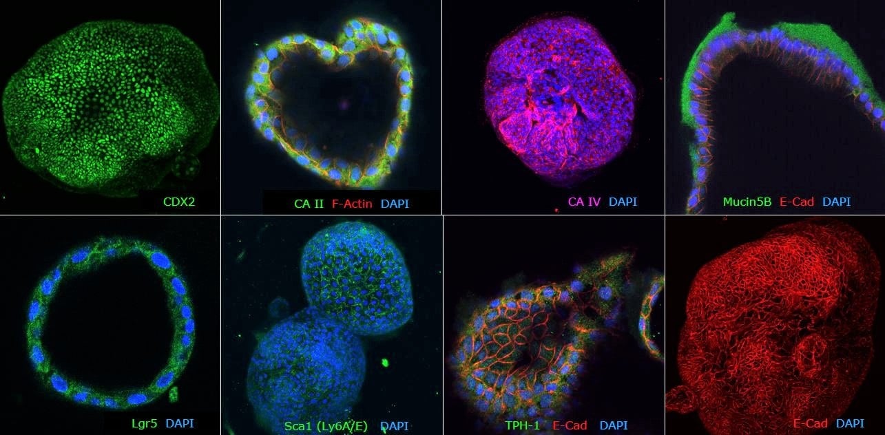 Immunocytochemical characterization of human colon organoids (Colon-87, SCC321). Human colon PDOs are positive for colon-specific markers: CA II, CA IV and Mucin5B, posterior hindgut marker: CDX2, stem cell markers: Lgr5 and Sca1 and epithelial markers: TPH-1 and E-Cad.