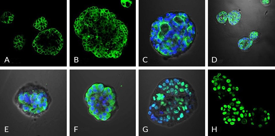 Microscopy image of lung cancer organoids displaying major epithelial markers