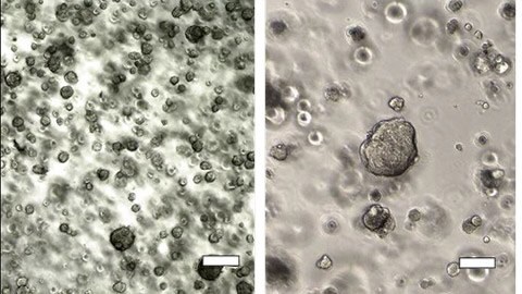 Histological and morphological comparison of acinar/papillary 3dGro™ human lung organoids