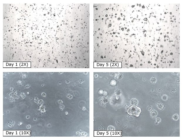 PDAC organoid time course Four microscopy images of pancreatic ductal adenocarcinoma organoids over a 5 day period. The first image shows the organoids at Day 1 at 2X, with small black dots covering the entirety of the image. The second image shows the organoids at Day 5 of growth at 2X magnification, with fewer, larger black circles scattered across the image. The third image shows the organoids at Day 1 at 10X magnification, with small clear circles on a grey image background. The fourth image shows the organoids at Day 5 at 10X magnification, with larger and fewer clear circles on a grey image background.