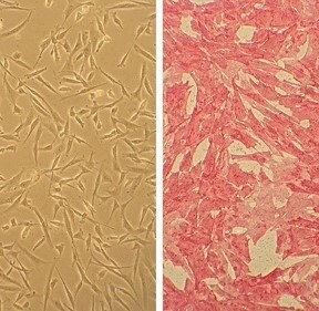 Human Coronary Artery Smooth Muscle Cells (HCASMC) Human Coronary Artery Smooth Muscle Cells (HCASMC)