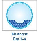 Blastocyst Day 3-4