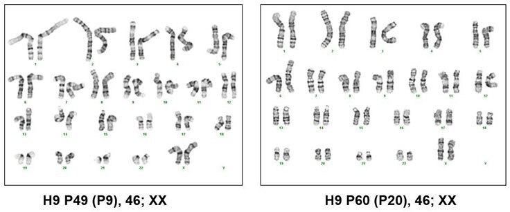 H9 human ES cells maintained using an every-other-day/no weekend feeding schedule in PluriSTEM™ media for 9 and 20 passages have normal female karyotypes. Karyotyping of pluripotent stem cells cultured in PluriSTEM™ media