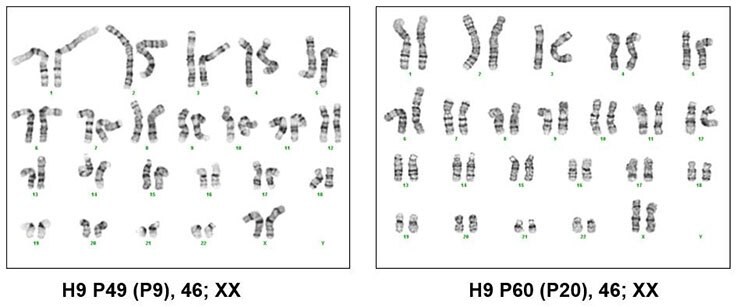 Karyotyping of pluripotent stem cells cultured in PluriSTEM™ media