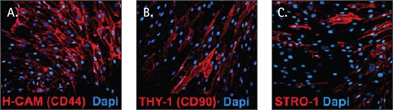 Mesenchymal Stem Cell Culture Human mesenchymal stem cell markers