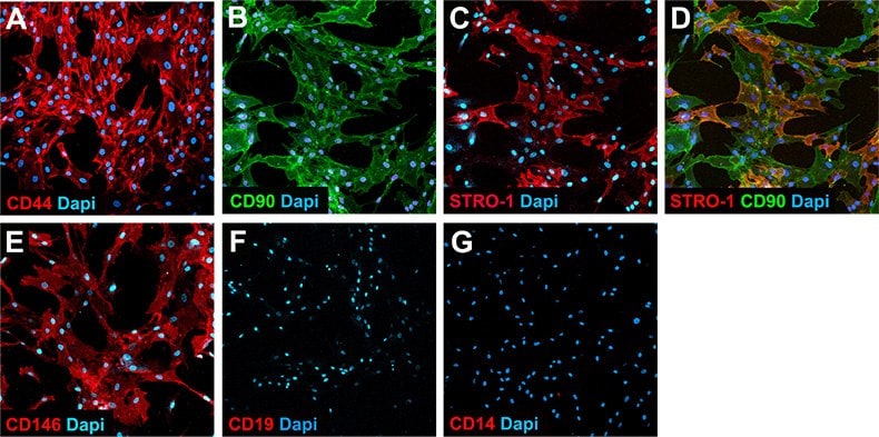 Immunocytochemical staining of cultured human bone marrow-derived mesenchymal stem cells stained