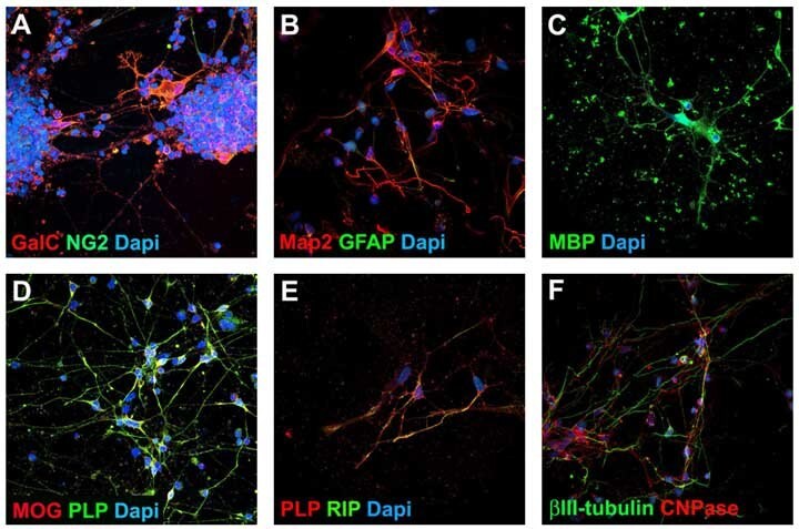 Oligodendrocyte Progenitor Cell Characterization