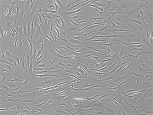 P4 bone-marrow mesenchymal stem cells grown in media containing 10% FBS