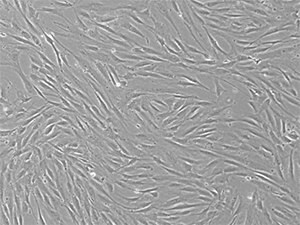 P4 bone-marrow mesenchymal stem cells